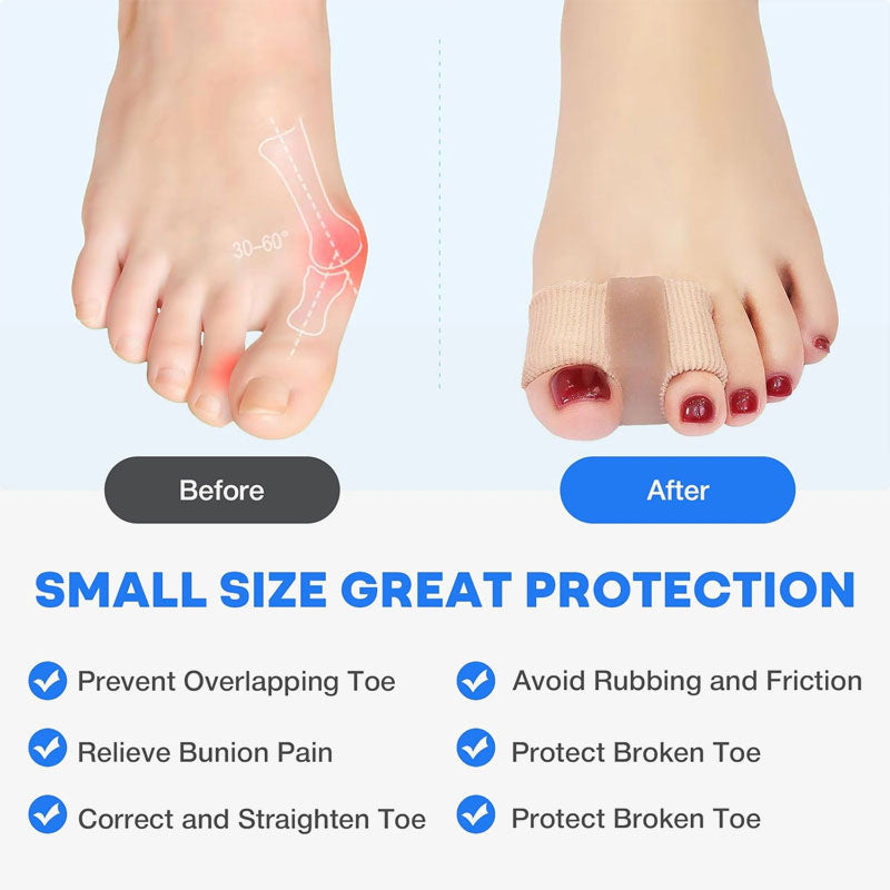 Tåseparator og hallux valgus-korrektor 🦶